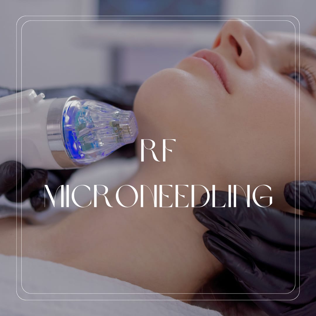 RF Microneedling