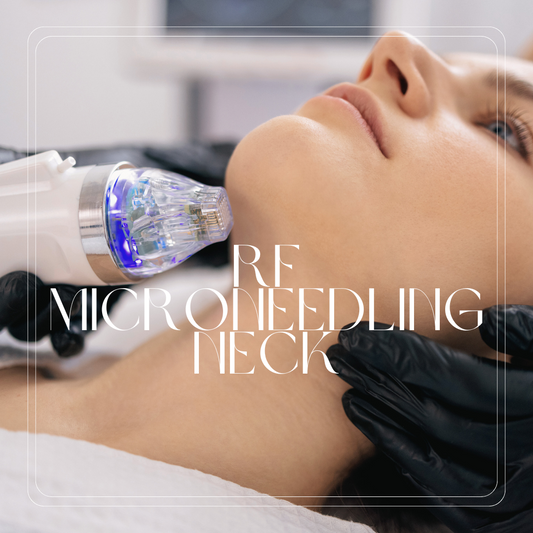 RF Microneedling - Neck