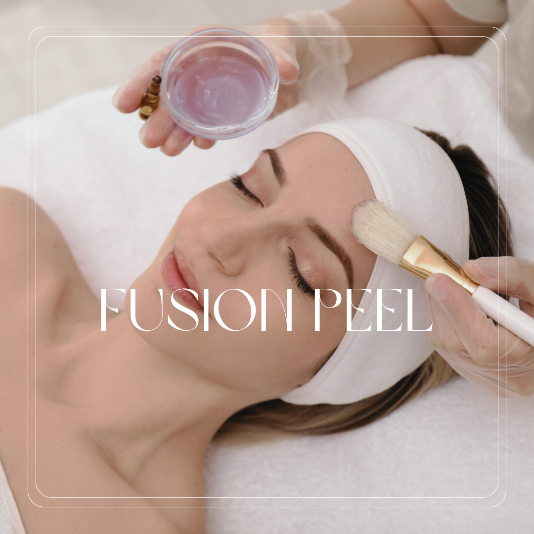 Fusion Peel